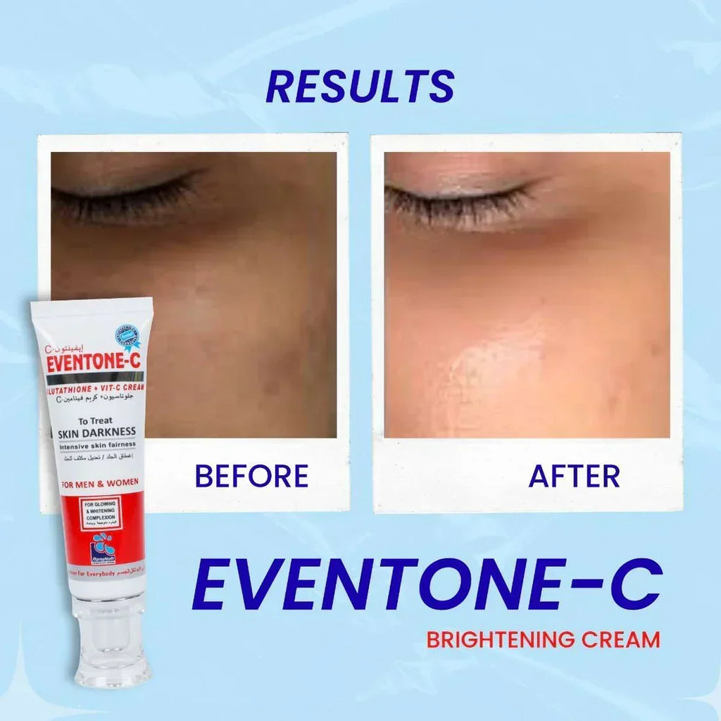 Eventone C Cream ( Skin whitening and Anti Aging ) BUY ONE GET ONE FREE